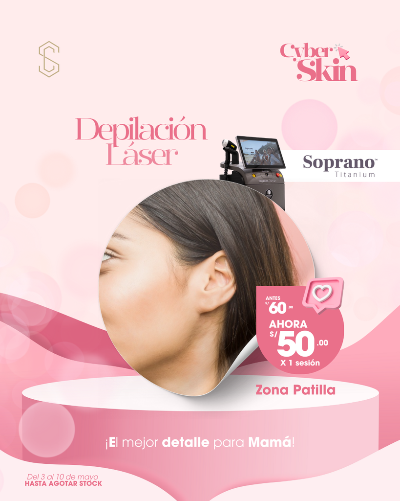 Depilación Láser - Patillas
